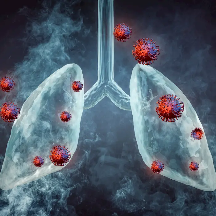 what is legionella